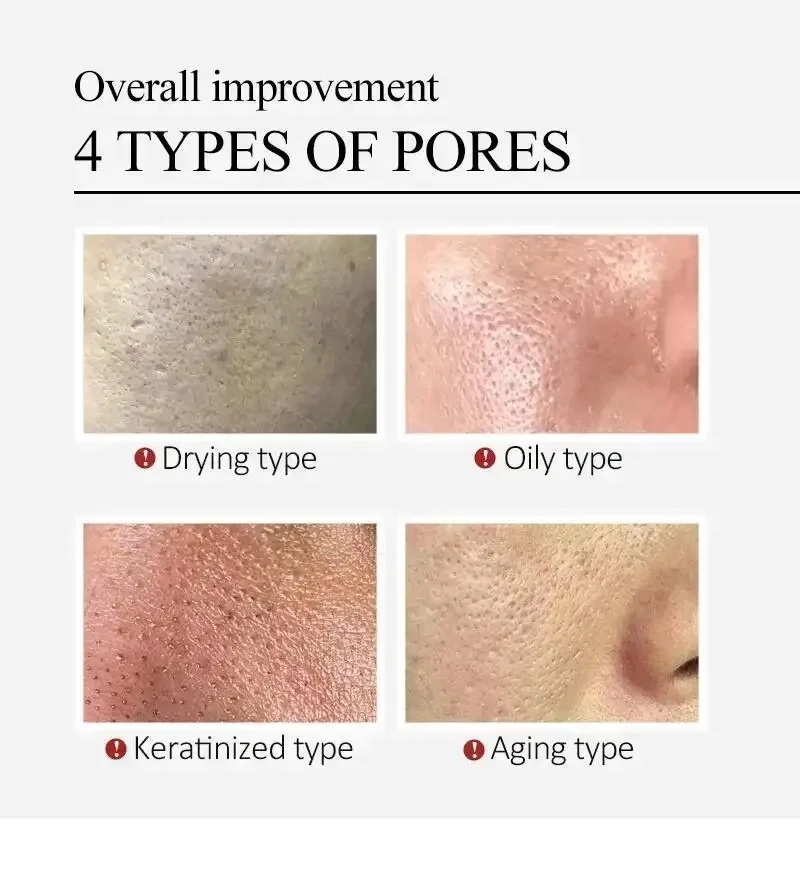 Centella Asiatica Shrink Pores - Luxury Skincare Korea 리뷰 및 가격